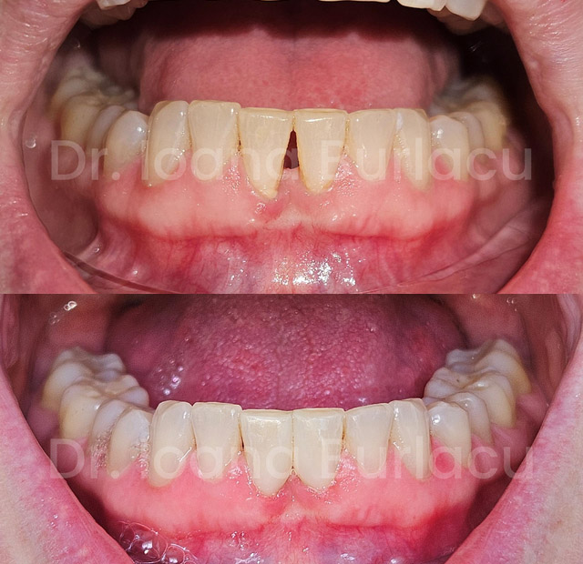 Cosmetic Dentistry